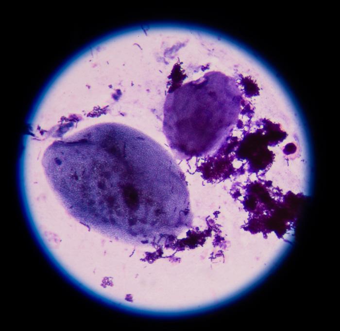 La terrorífica bacteria 'carnívora' que ya devoró su cuarta víctima en EE.UU.-0
